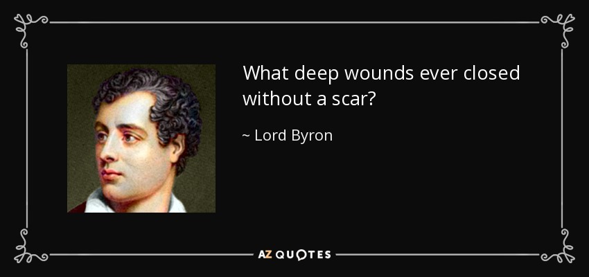 What deep wounds ever closed without a scar? - Lord Byron